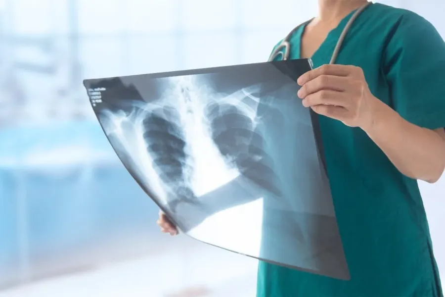 Clinician holding a chest X-ray